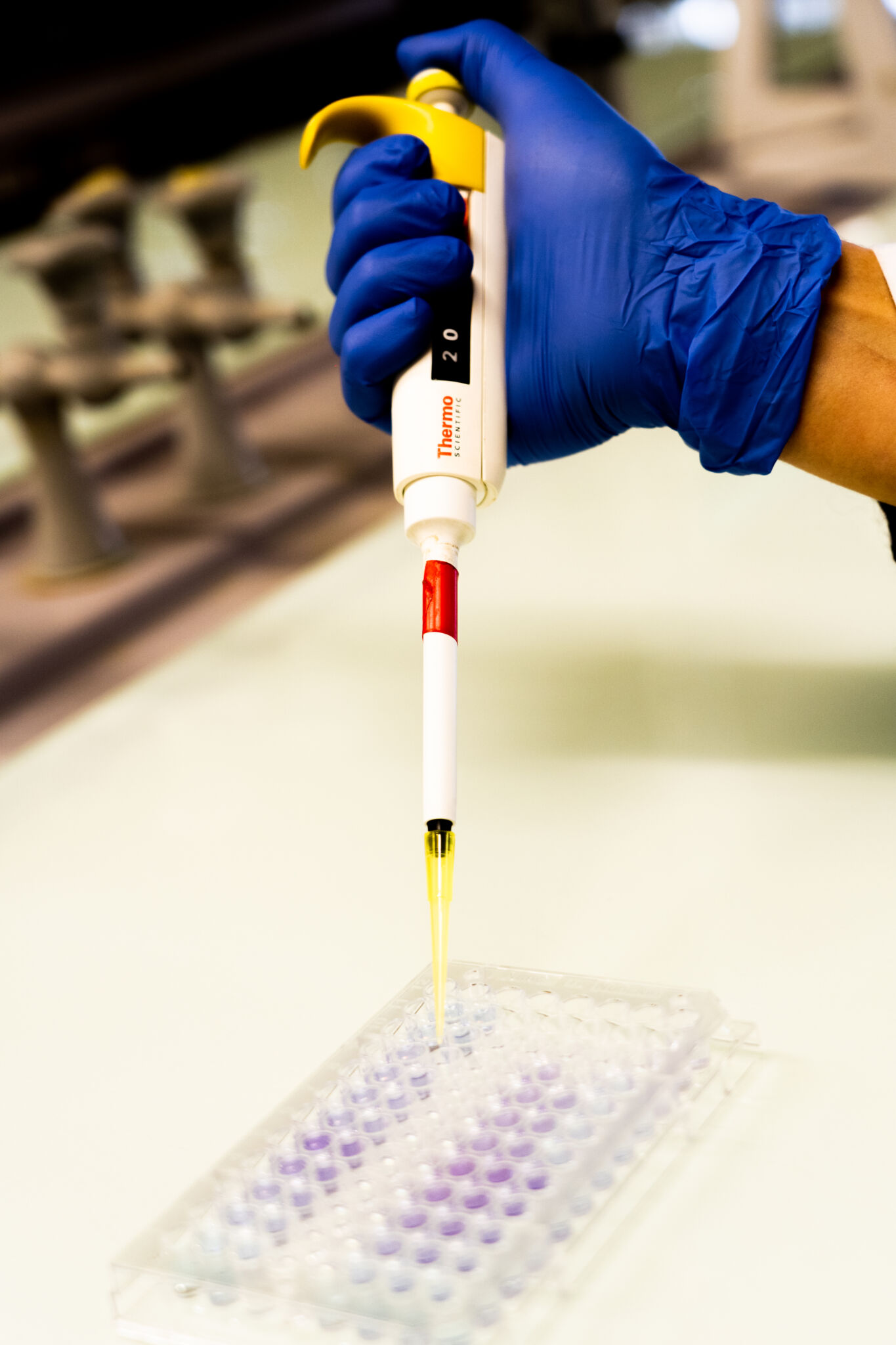 Dut Génie Biologique Parcours Diététique Et Nutrition